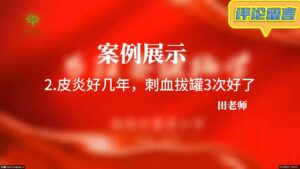 案例展示2 3年皮炎，3次刺血拔罐好了