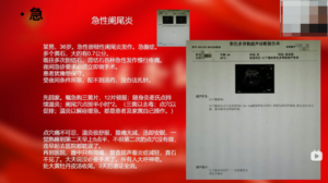 案例展示20 急性阑尾炎（粪石嵌顿）